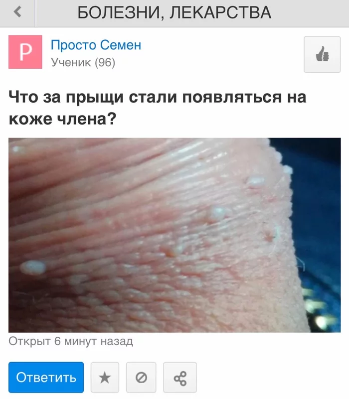 What kind of acne? - Humor, Mail Laughter, Mailru answers, Memes