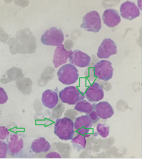 Laboratory diagnostics. Microscopy - My, Laboratory, Diagnostics, Microscope, Microscopy, Analysis, Longpost