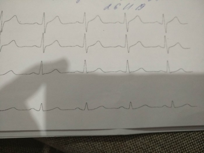   37 ,  , 