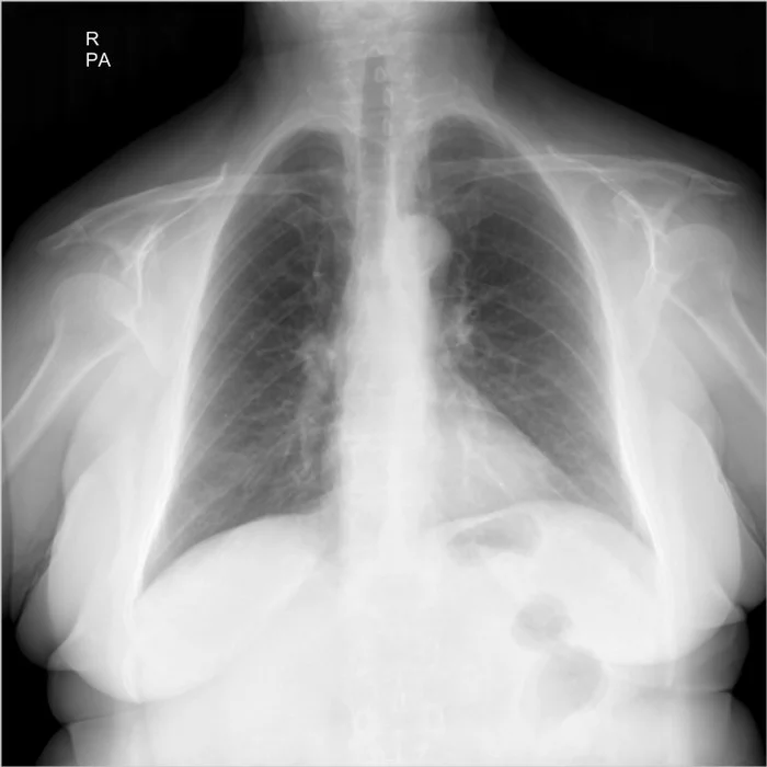 I ask the medical league for help in deciphering the x-ray image - My, The medicine, X-ray, Longpost, Help