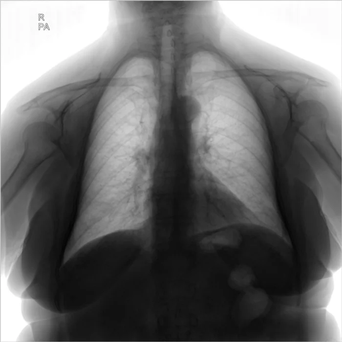 I ask the medical league for help in deciphering the x-ray image - My, The medicine, X-ray, Longpost, Help