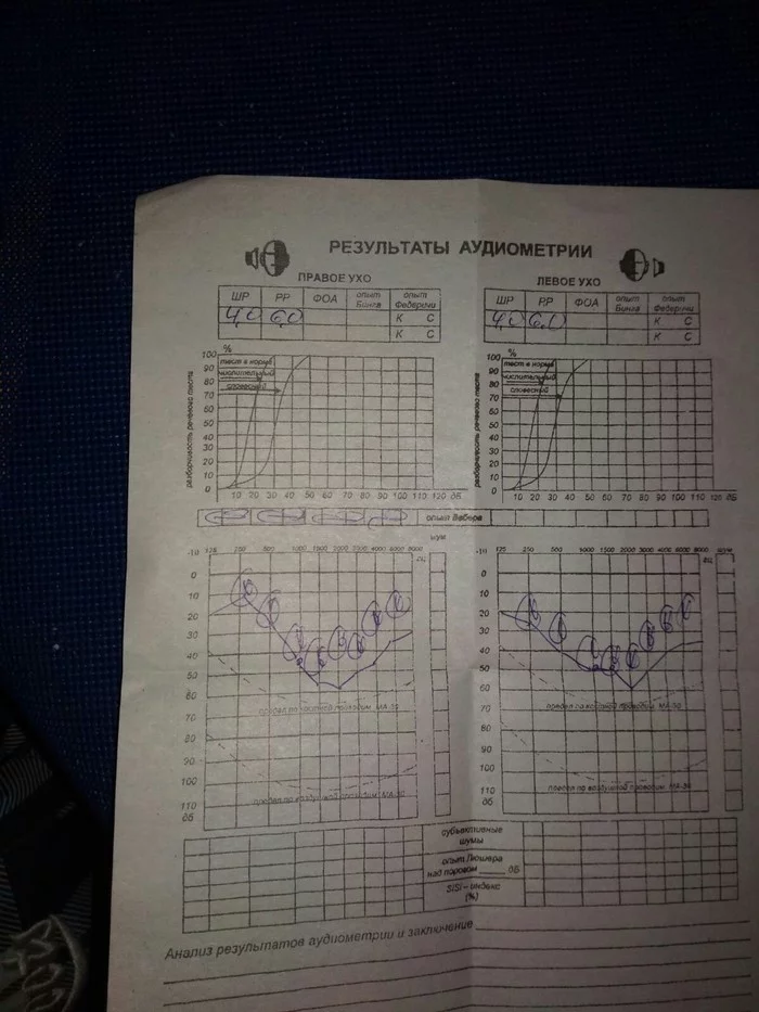 Decoding the audiogram - ENT-Doctors, Doctors, Help, Decryption, Hearing