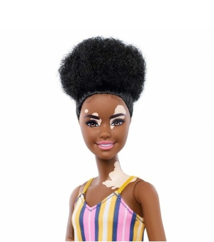 BARBIE DOLLS HAVE BEEN PRODUCED WITHOUT HAIR AND WITH VITILIGO - Barbie Girl, Mattel, Handmade dolls, Games, Vitiligo, Accordion, Longpost