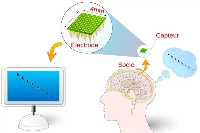 The neural interface has been hacked. Isn't it time to address security in this area? - IT, Brain, Interface, Breaking into