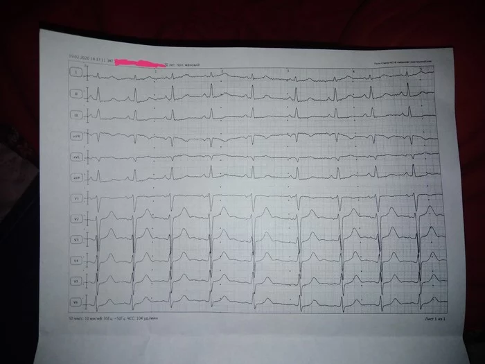 ECG interpretation - My, The medicine, ECG, Cardiology, Cardiogram, Heart, Longpost