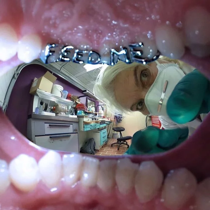 Feed me - Braces, Dentist, Unusual, The photo, Inscription, Teeth, Foreshortening