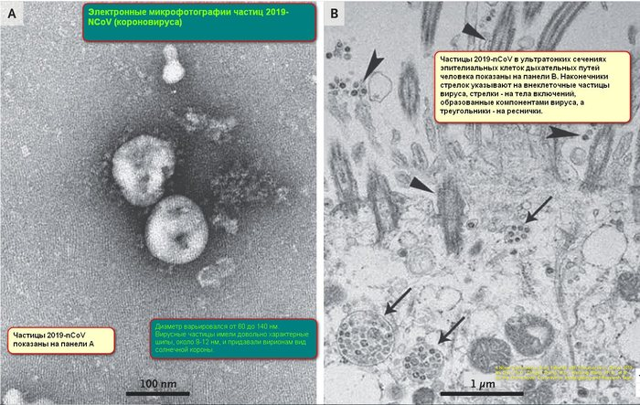 On the topic of the day or about the new coronavirus (information from scientists) - Coronavirus, Forum, Copy-paste, Longpost