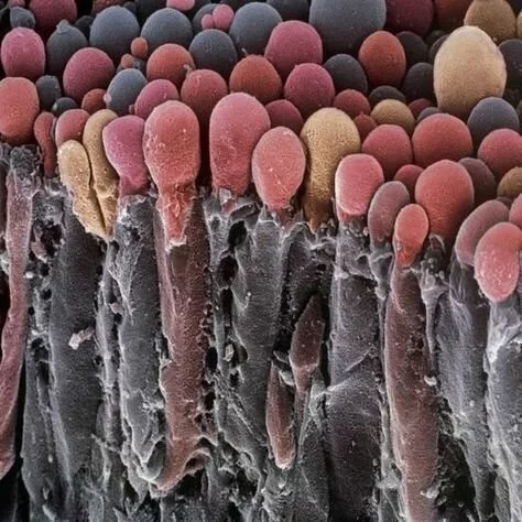 Макрофото о секретах нашего тела Макросъемка, Биология, Длиннопост, Электронный микроскоп