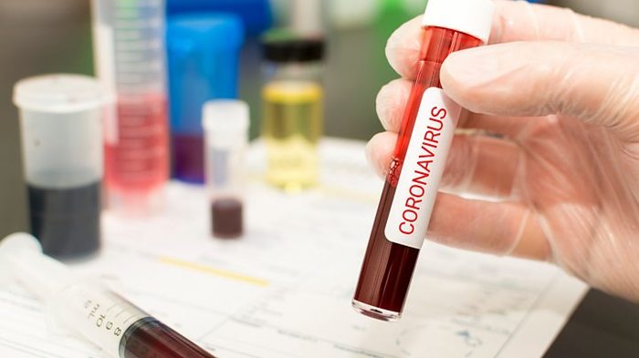 US begins testing COVID-19 vaccine - USA, Coronavirus, Vaccine, Trial
