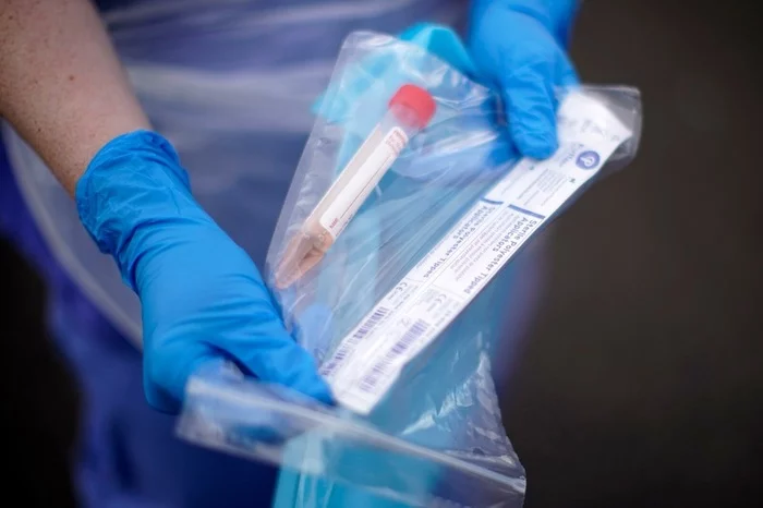 A TEST SYSTEM FOR ANTIBODIES TO CORONAVIRUS HAS BEEN REGISTERED IN RUSSIA - news, Coronavirus, Test System