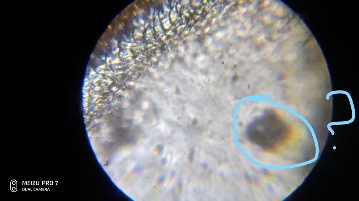 What kind of artifacts are there in a microscope? - My, Microscope, Help, Mystery, Optics, Microscopy, Vision