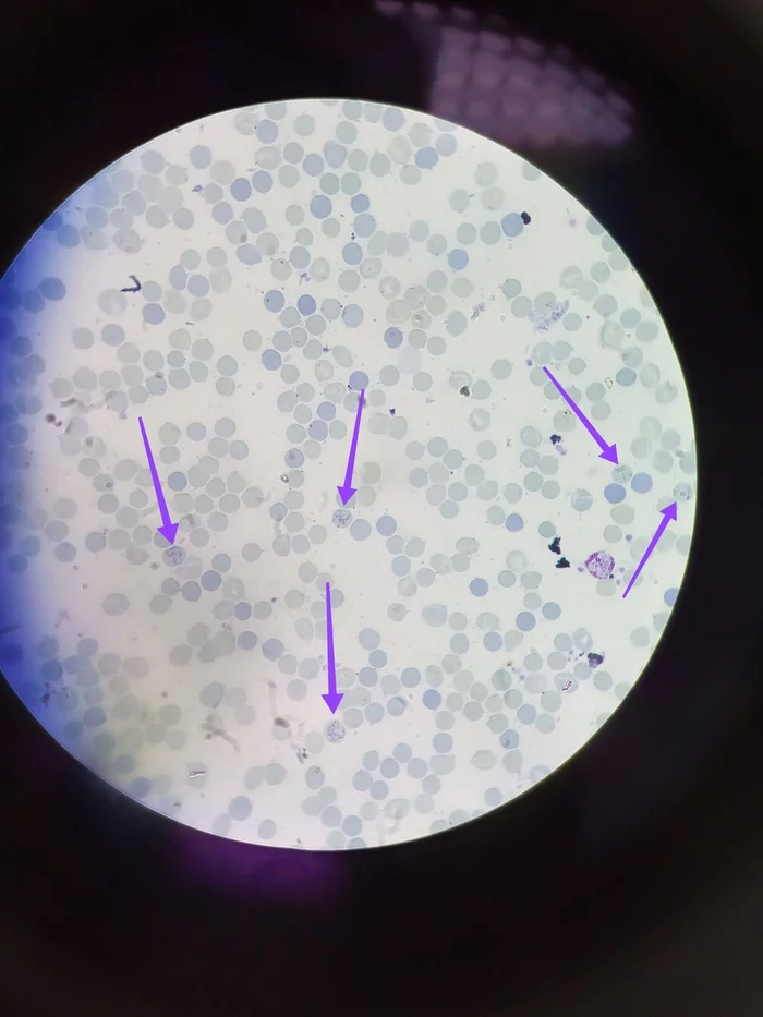 Reticulocytes - Blood, Kld, Analysis, Laboratory, Microscope, Microscopy, The medicine, Longpost