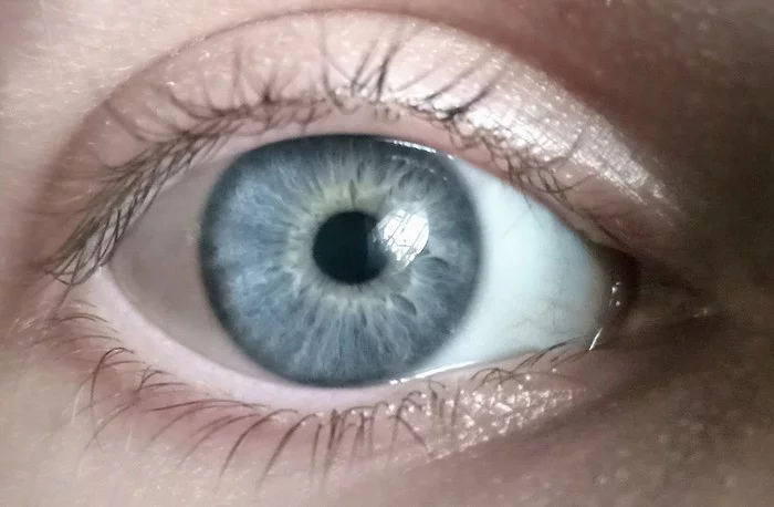 How do you like my eyes? - My, Eyes, Blue eyes, Iris