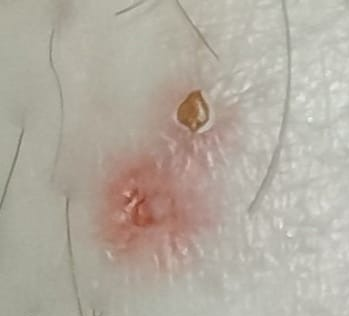 Someone bites at home. We just can’t figure out who it is. Help with advice - My, Insects, Bite, Text