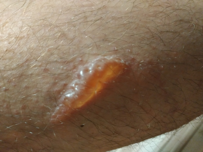 Врачи, нужна помощь. Что это за хрень? Оно прозрачное на свету