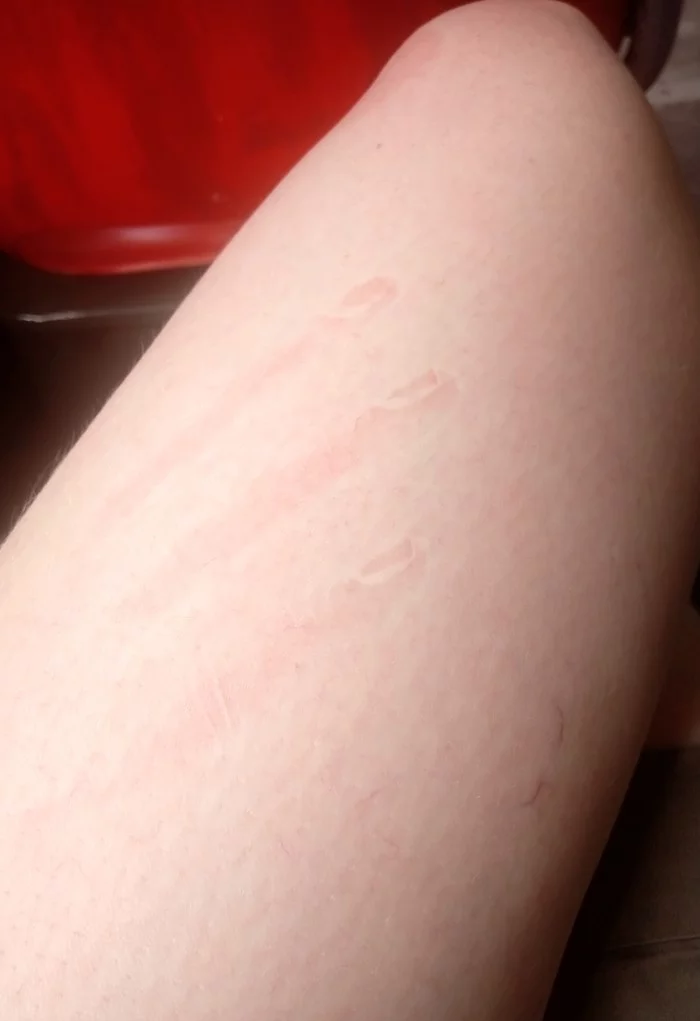 When I slept on my arm - My, Leather, Body, Handprint