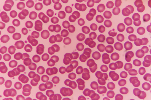 Blood under a microscope. Part 1. Red blood cells, neutrophils ...