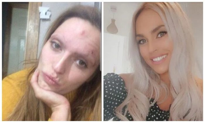 The girl turned from a gloomy drug addict into a real beauty, overcoming addictions - Scotland, Positive, Girls, Addiction, Longpost, It Was-It Was