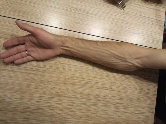 My hand - My, Arms, Veins, Not drugs