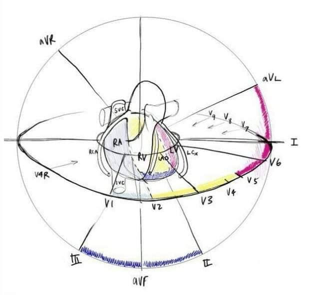 Excellent picture of ECG leads - ECG, Heart