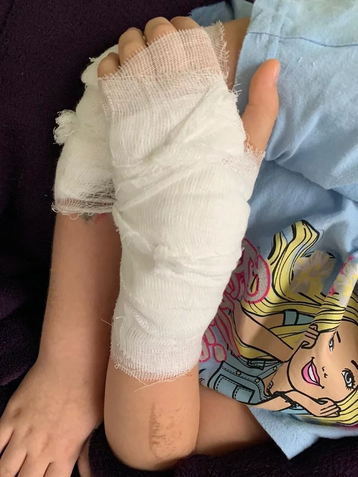 In Kaliningrad, a surgeon at a children's regional hospital operated on the wrong arm of a child. - Negative, The medicine, Negligence, Video, Mat, Longpost