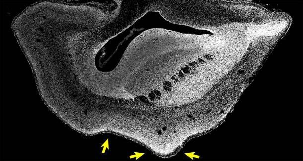 Human gene transplanted into monkeys - Scientists, Genetic Engineering, Brain, Monkey, Planet of the apes, Experience, The science, Biology, Animals, Longpost, The national geographic, Marmosets