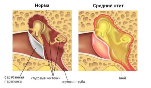 Cold. Mayo Clinic Recommendations - My, Evidence-based medicine, Translation, Cold, Longpost, GIF