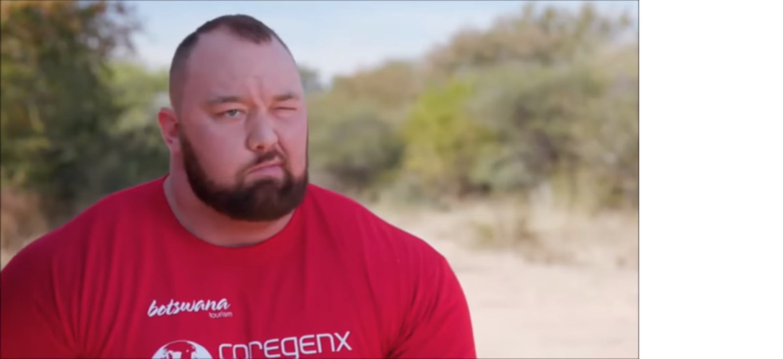 Hafthor Bjornsson suffers from Bell's palsy - Haftor Bjornson, Person, Video