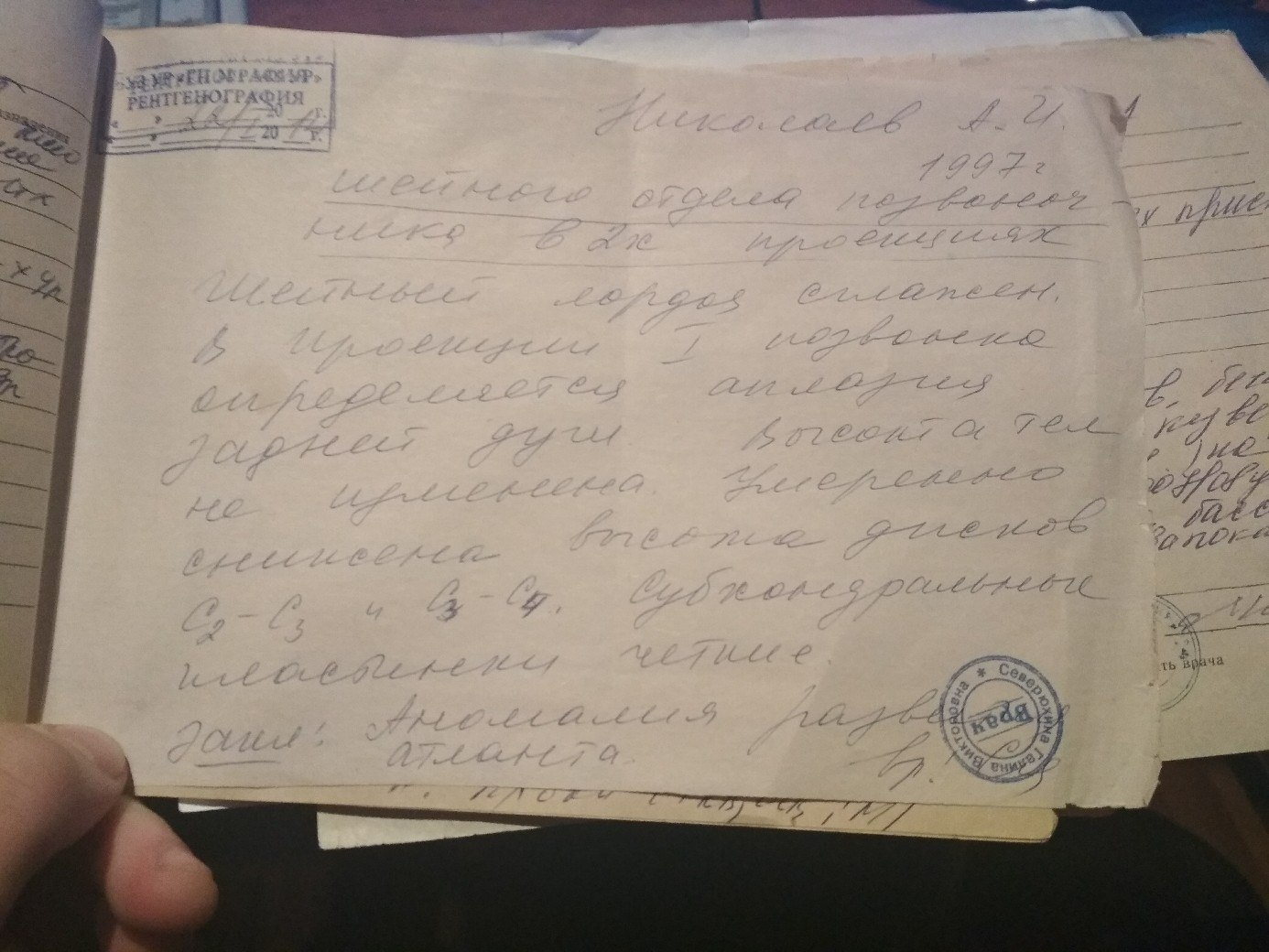 I am looking for doctors to consult about my congenital disease (aplasia of the posterior arch of the atlas) - My, The medicine, Neck, Doctors need help, Military enlistment office, Brain