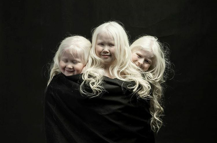 albino children - Yakutia, Children, Albino, Copy-paste, Longpost