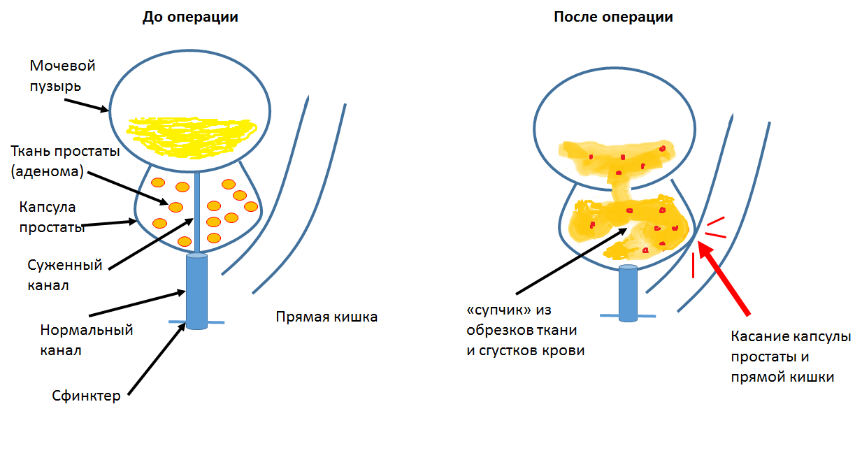 Всем, кото ждет ТУР(п). А также их верным подругам, желающих поддержать  своих любимых. | Пикабу