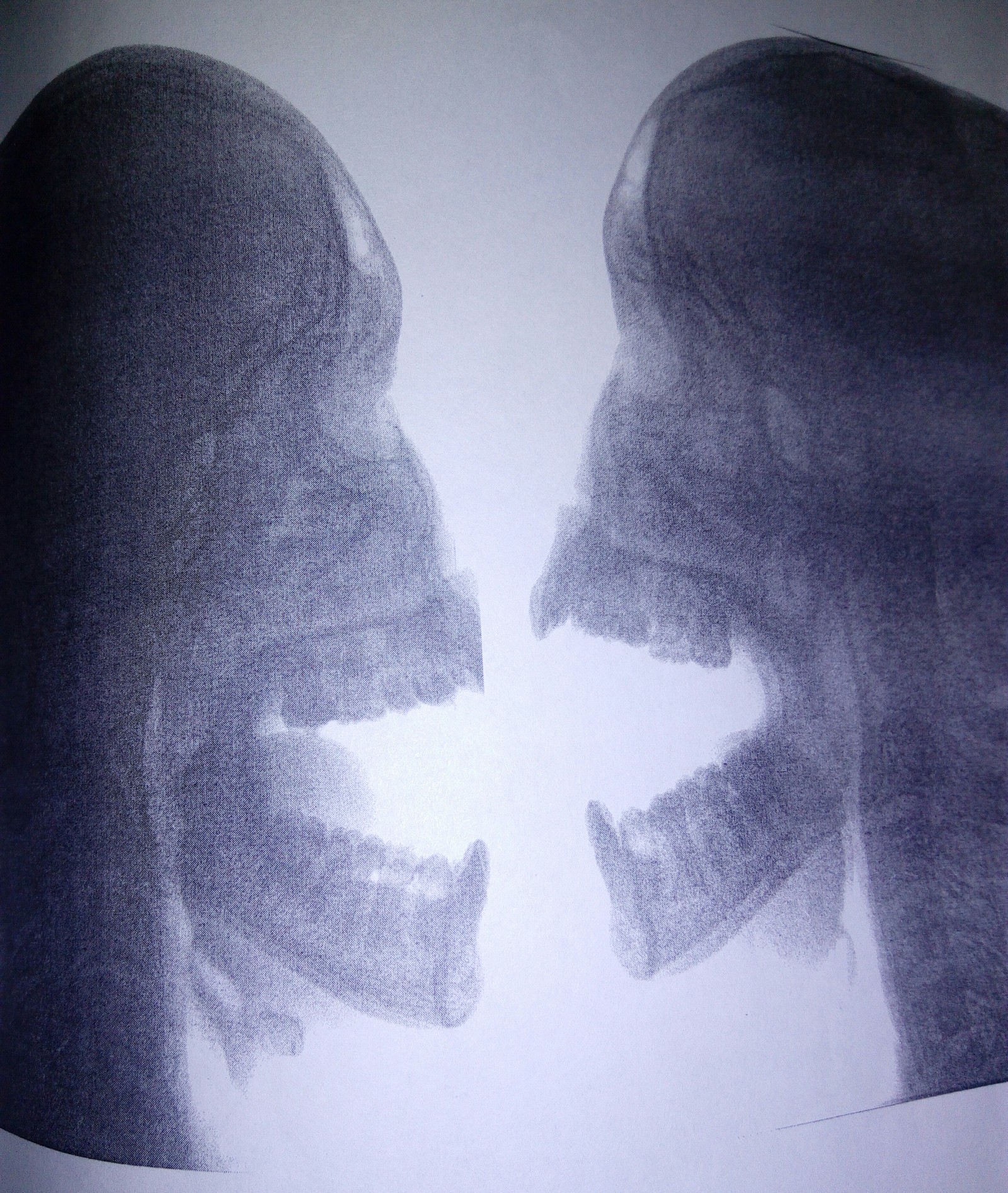 Predator versus Alien. - My, X-ray, Predator, Stranger, Predator (film)