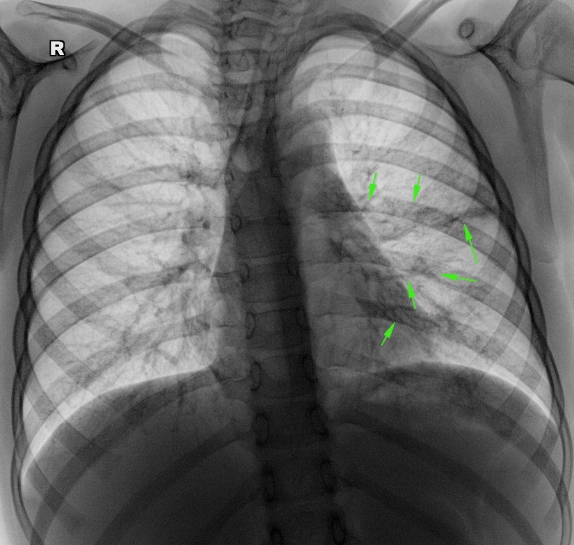 From the life of a radiologist. Part 19 - My, X-ray, The medicine, Longpost, The photo