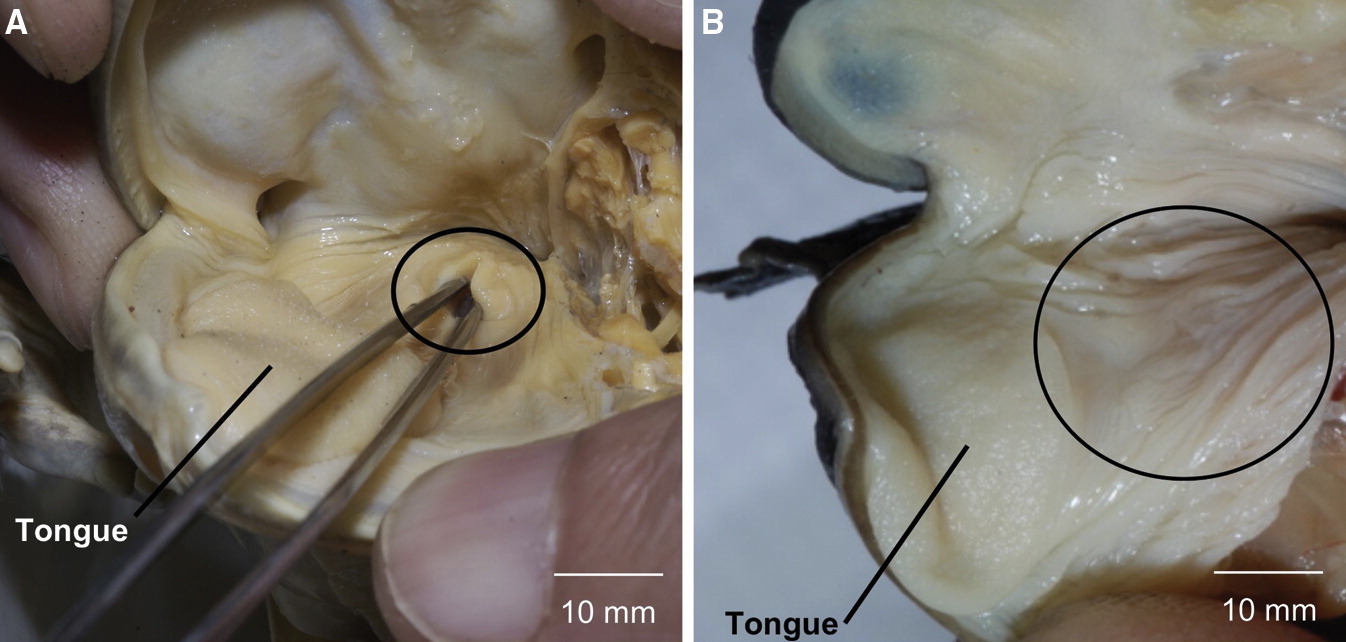 Frog without lungs - The science, Biology, Amphibian, Amphibians, Frogs, Interesting, Copy-paste, Elementy ru, Longpost