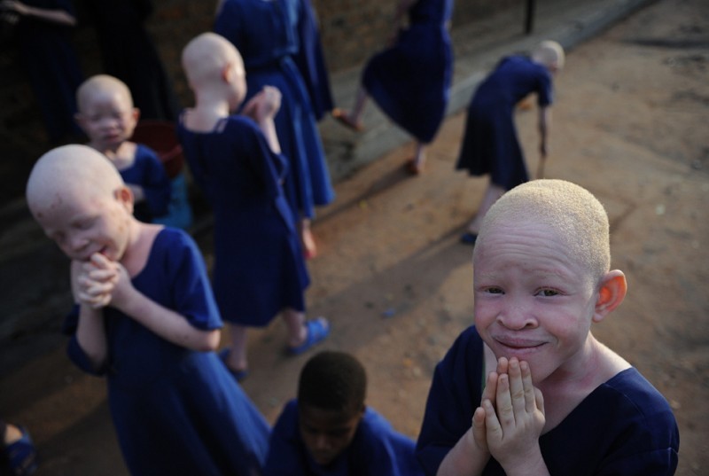 Facts about albinism - Albino, , Text, Longpost, Facts, Interesting