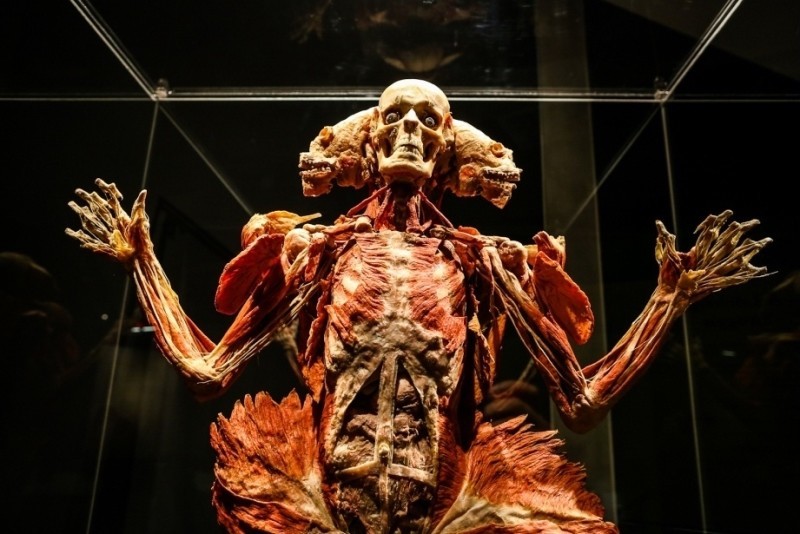 Plastination - insanity or art? - Plastination, Mummy, , Exhibition, , Dead body, Longpost, GГјnther von Haggens