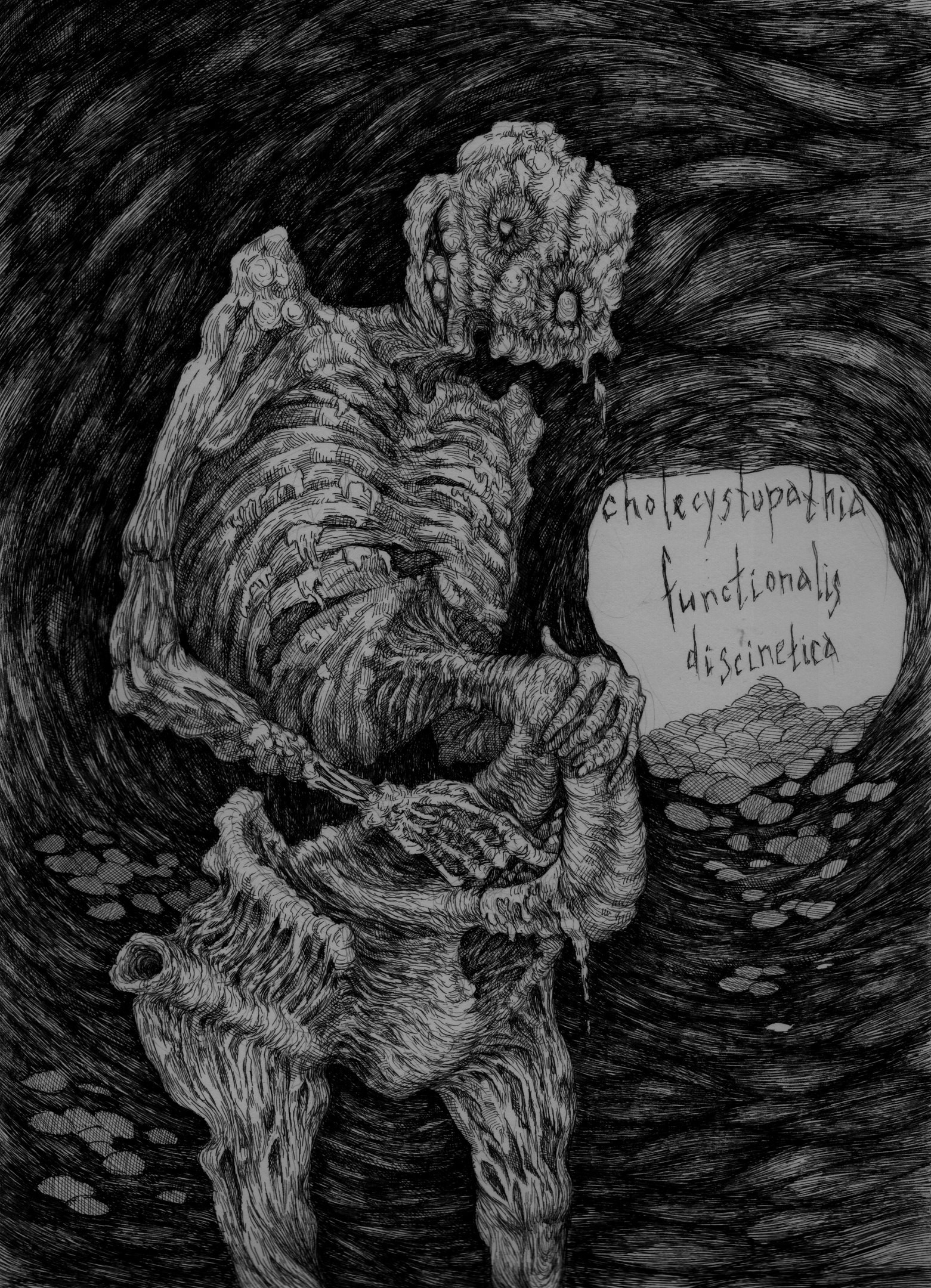 Vegetovascular dystonia - Drawing, Creation, Disease, Monster, Longpost