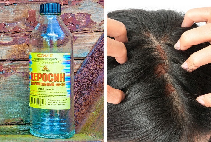 9 популярных народных рецептов для волос, используя которые, вы рискуете  испортить свою шевелюру | Пикабу