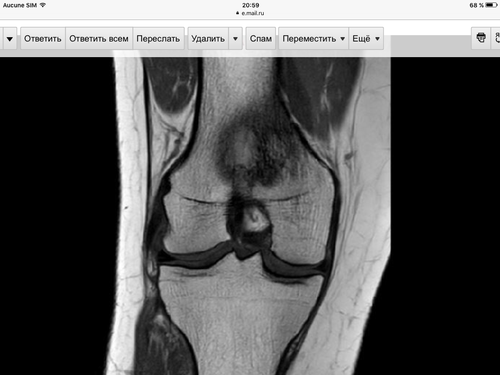 Help identify the pain. - My, Health, Diagnosis, Diagnostics, Doctors, Medications, Knee, Veins, Blood circulation