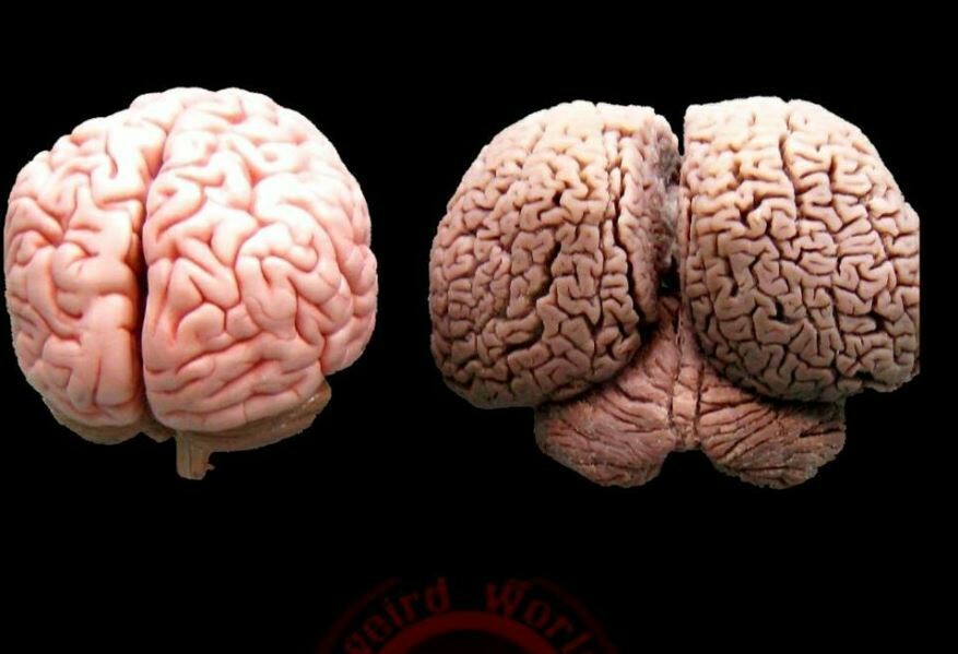 Human brain on the left, dolphin brain on the right. - The photo, Interesting, The science, Person, Dolphin, Brain, Informative