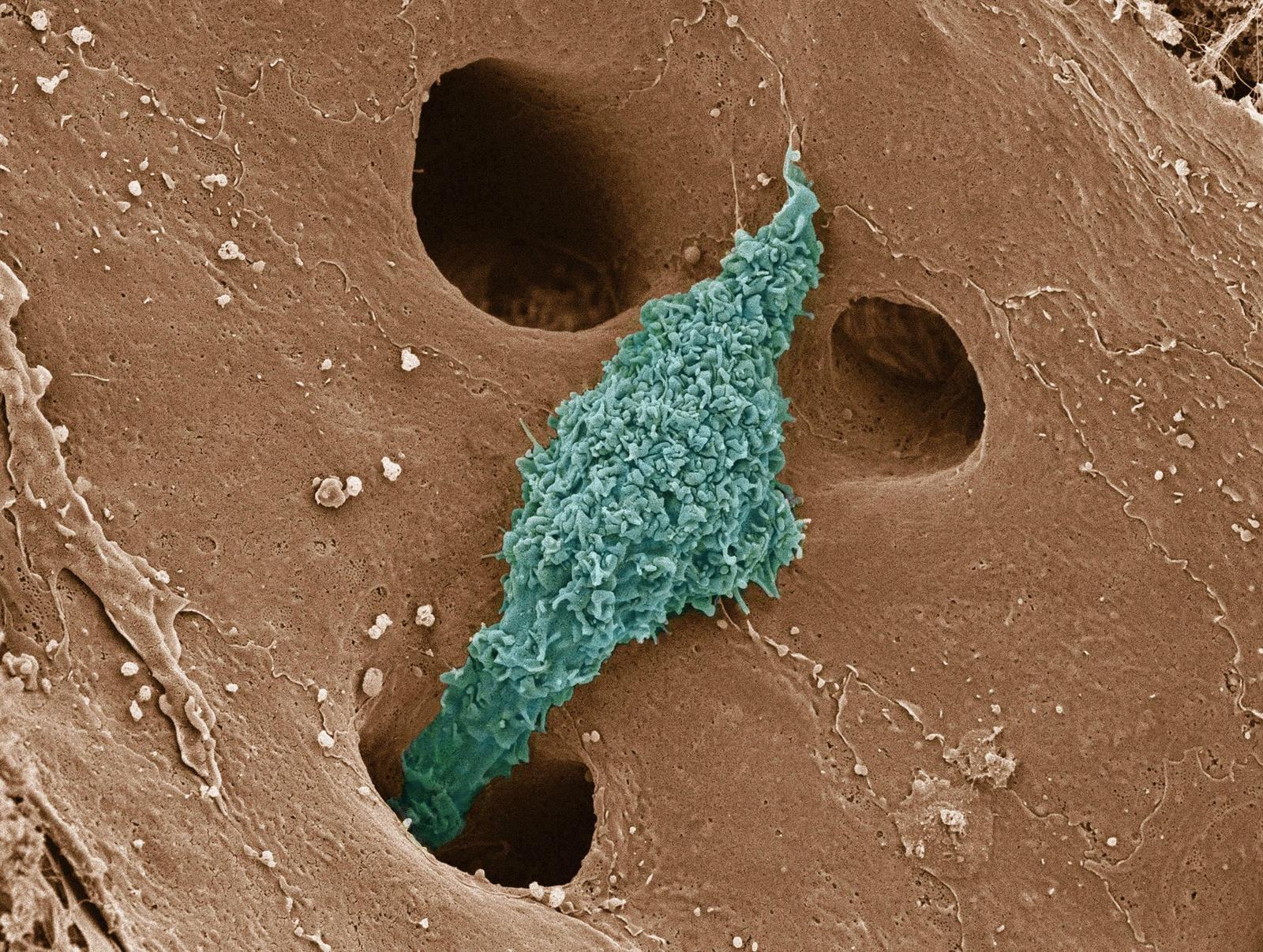 Поры кожи человека под микроскопом
