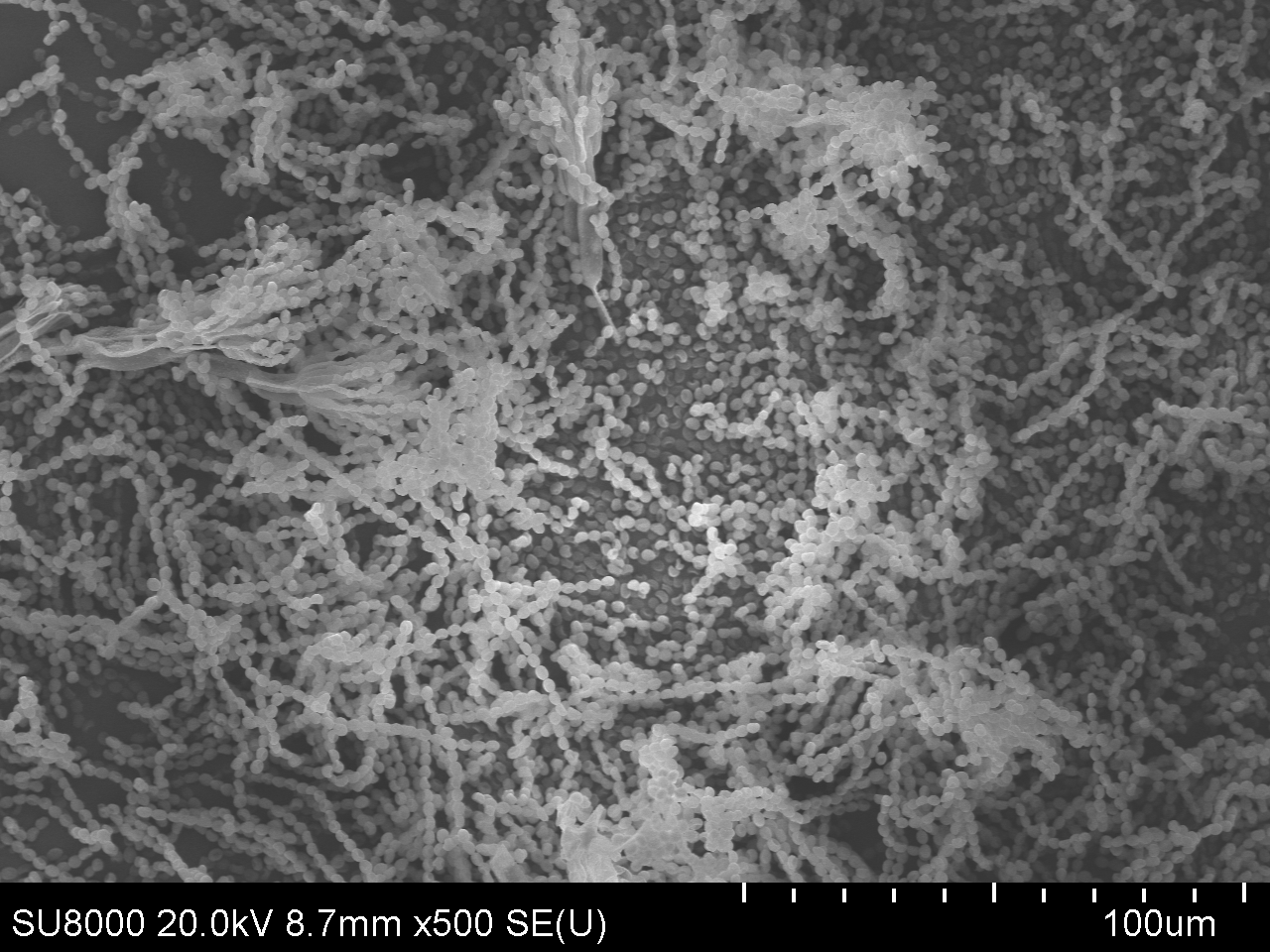 Mold under the electron microscope - My, Mold, Interesting, Microworld, Longpost, Electron microscope