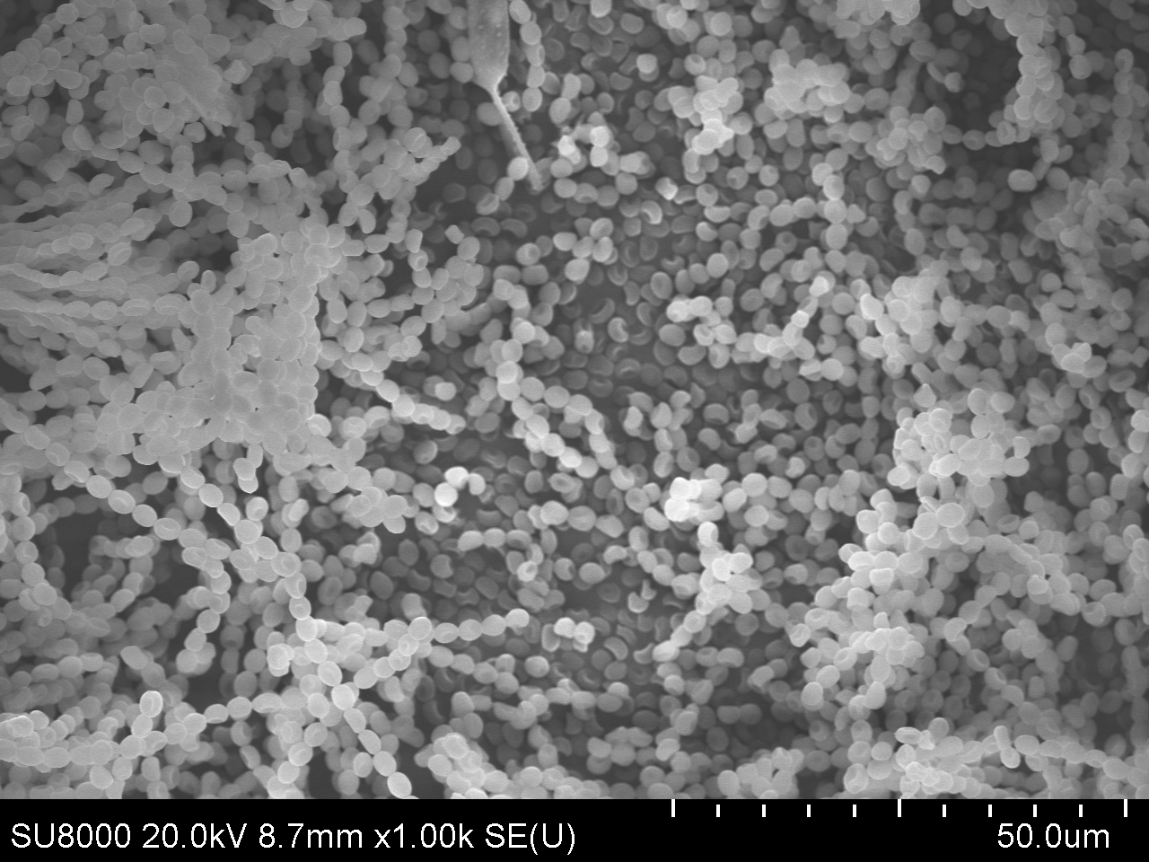 Mold under the electron microscope - My, Mold, Interesting, Microworld, Longpost, Electron microscope