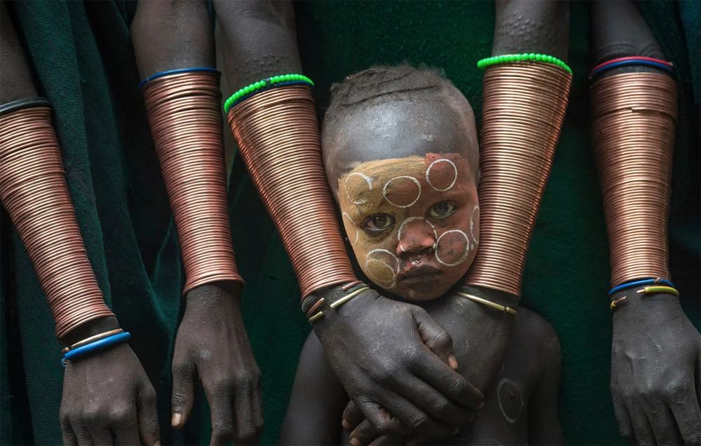 Your face when your drunk dad put cans on you. - Humor, Africa, The photo, Medical Banks