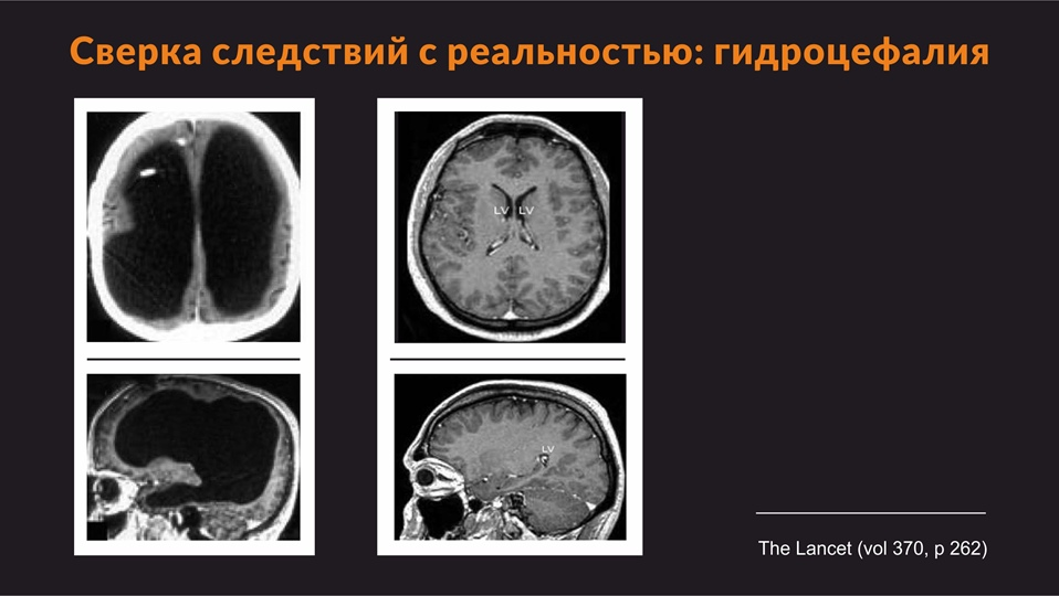 Телегония и мат против биотехнологий. Александр Панчин. Ученые против мифов 8-7. Часть 2 - Моё, Наука, Александр Панчин, Телегония, Антропогенез ру, Длиннопост