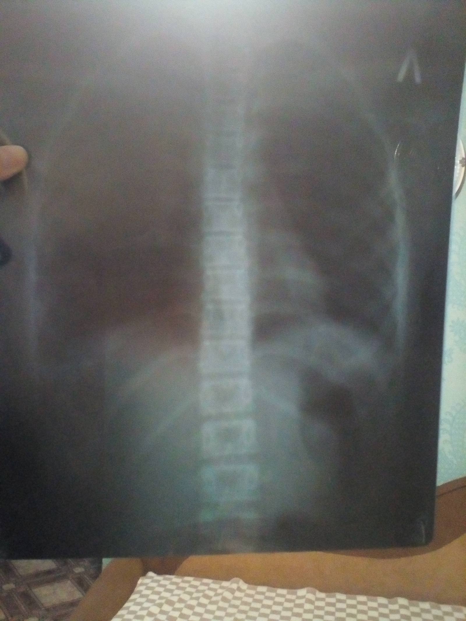 Peekaboo, please help, I'm at a loss - My, X-ray, Help, No rating, Doctors, Doctors need help, Longpost