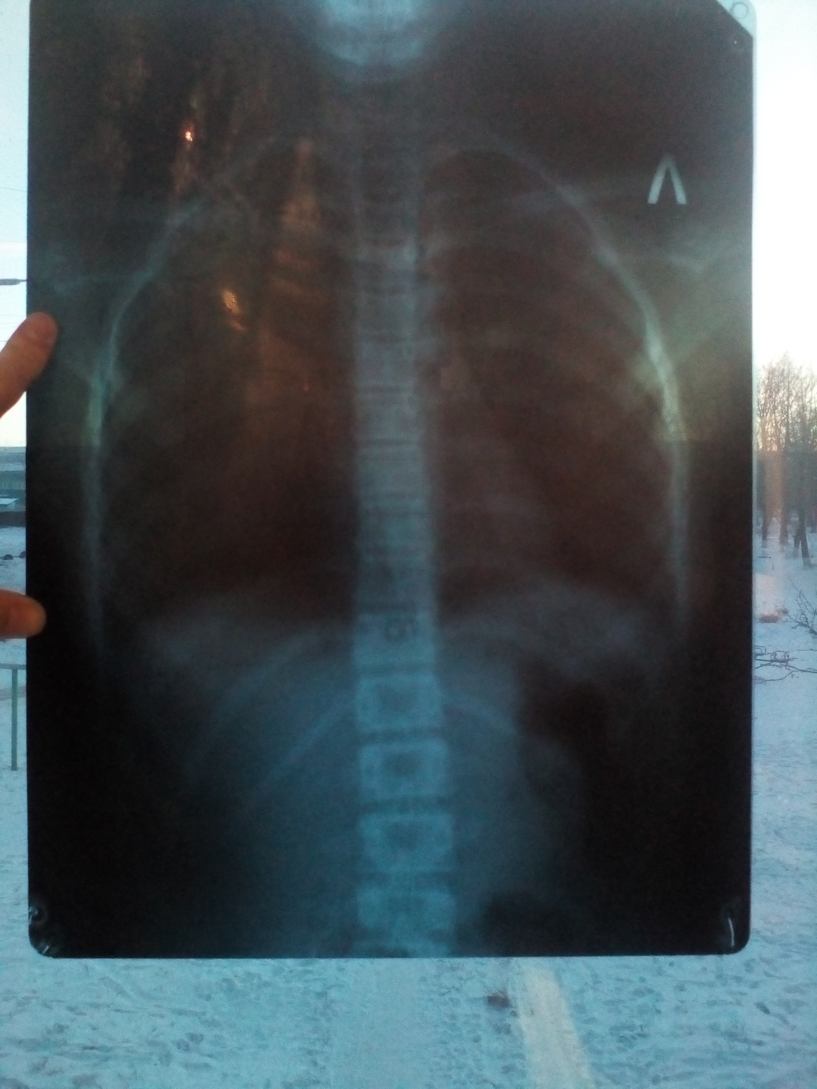 Peekaboo, please help, I'm at a loss - My, X-ray, Help, No rating, Doctors, Doctors need help, Longpost