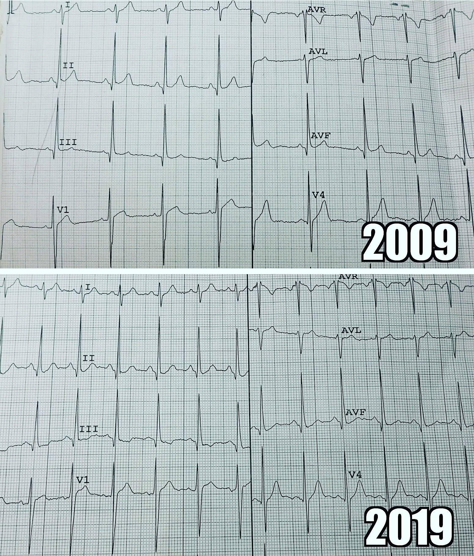 Мой #10yearschallenge - Моё, Здоровье, 10yearschallenge