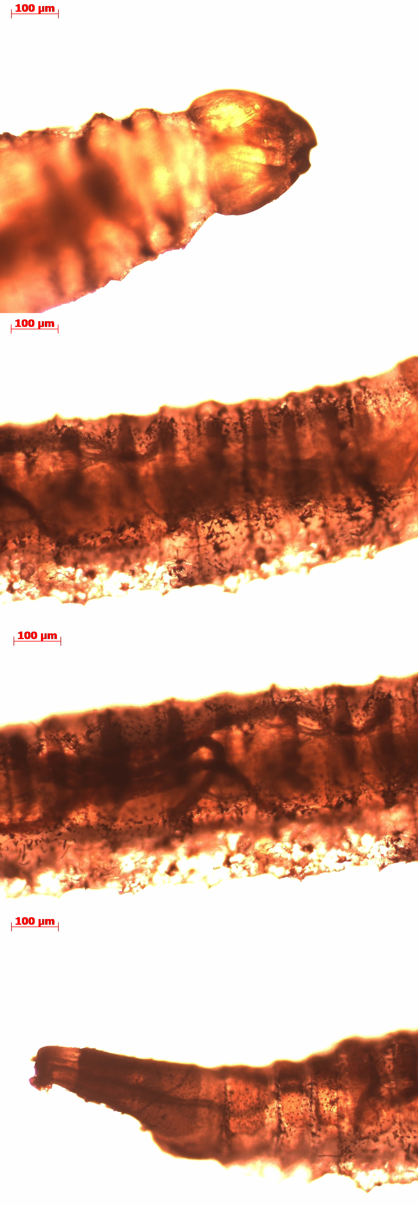 What kind? - My, Parasitology, Parasites, Longpost