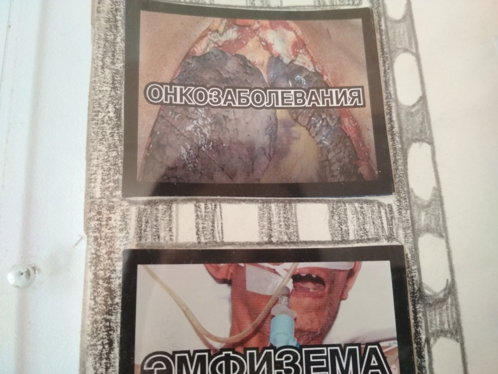 Campaigning against smoking - My, School, Smoking control, Poster, Longpost